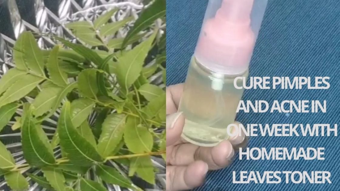 Neem Leaves Toner for Face Mask Acne homemade remedy