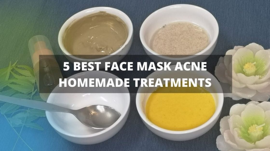 Face Mask Acne Homemade Treatments
